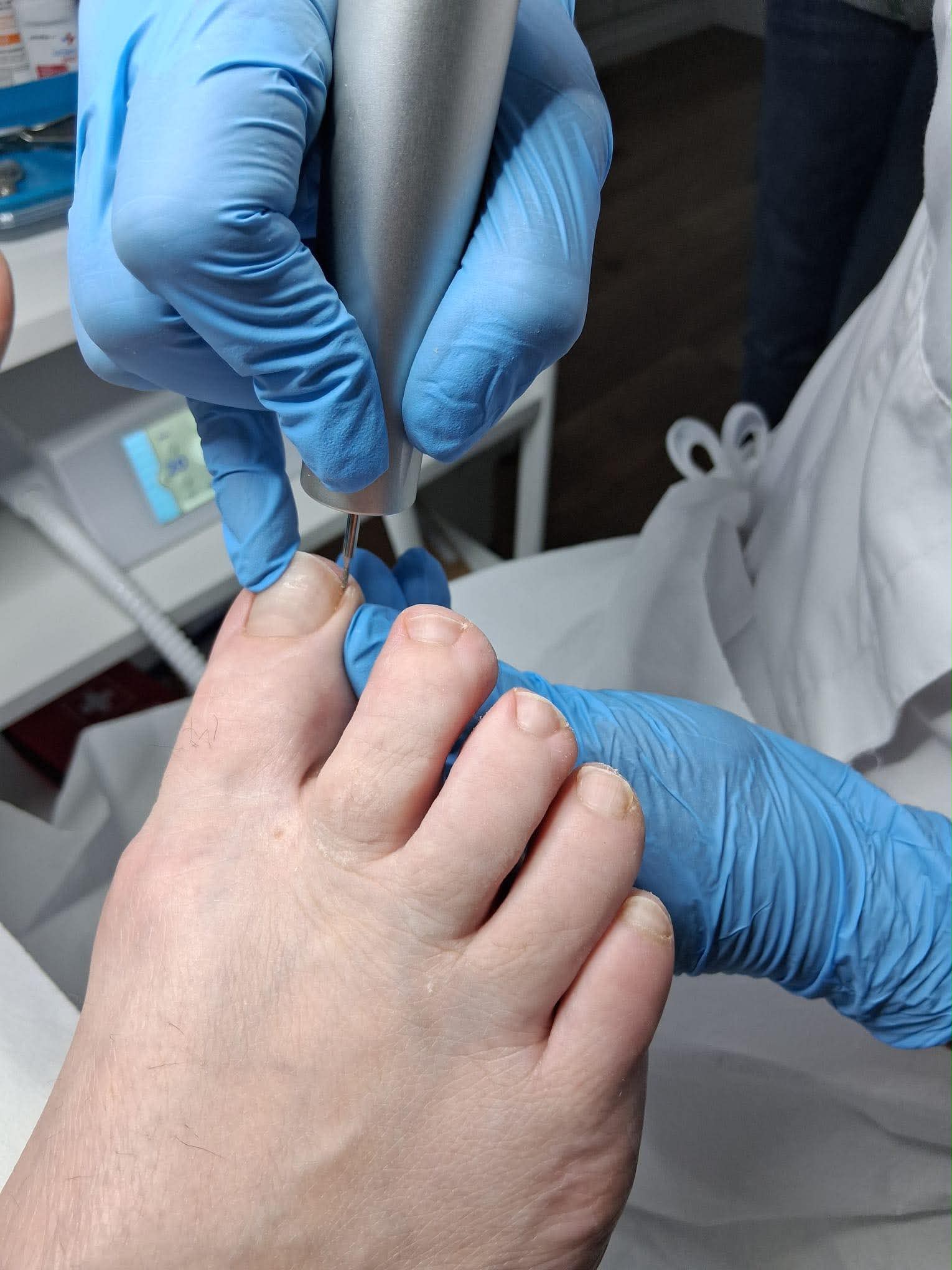 Ruhige Vorbereitung für eine mobile Fußpflegebehandlung